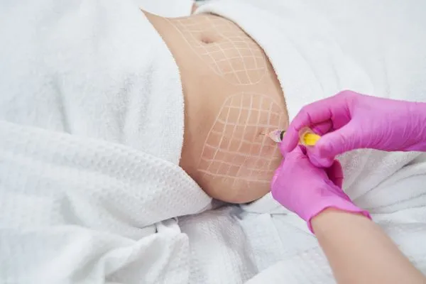 image of fat dissolving injections on love handles to help combat weight gain Handsworth Wood