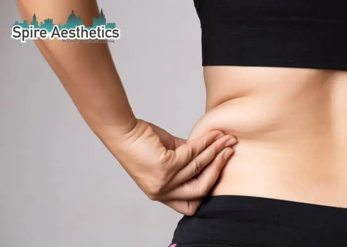 Image of woman pinching fat on their hips Handsworth Wood. Fat Freezing treatment