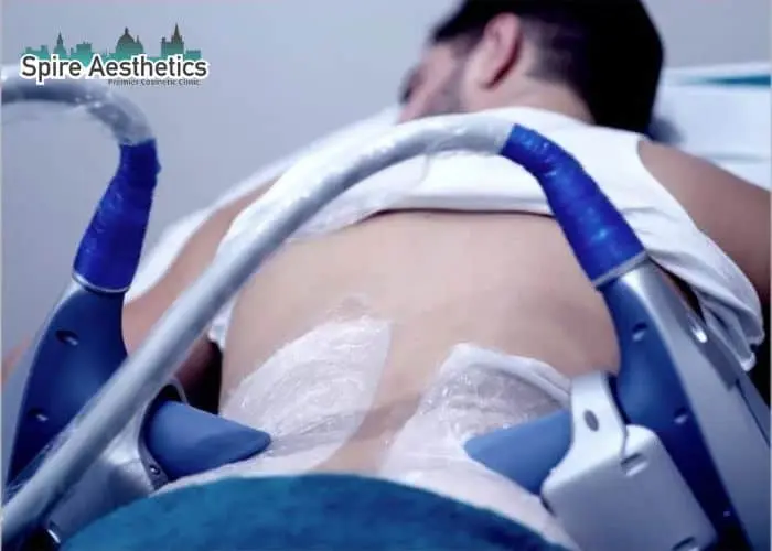 Man having fat freezing treatment done on love handles before a competitions Handsworth Wood to create a sculpted look.